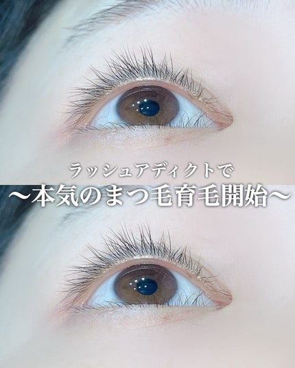 ラッシュアディクト アイラッシュコンディショニングセラム/soaddicted/まつげ美容液を使ったクチコミ(1枚目)