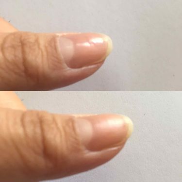3ステップつめみがき Daisoの口コミ 超優秀 100均で買えるおすすめネイル用品 爪に縦線とかボコボコし By Saori 敏感肌 代前半 Lips