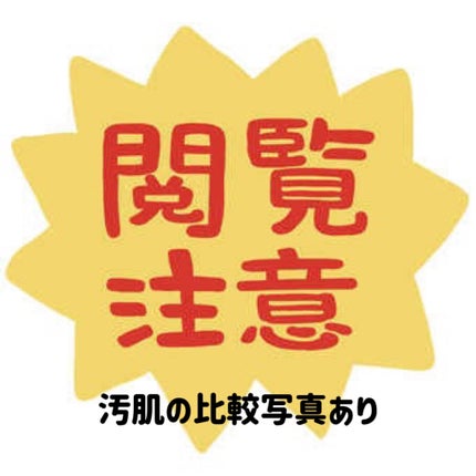 リードルショット300/VT/美容液を使ったクチコミ(6枚目)