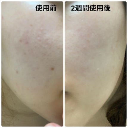 バイオ コンディショニング エッセンス/IOPE/ブースター・導入液を使ったクチコミ(3枚目)