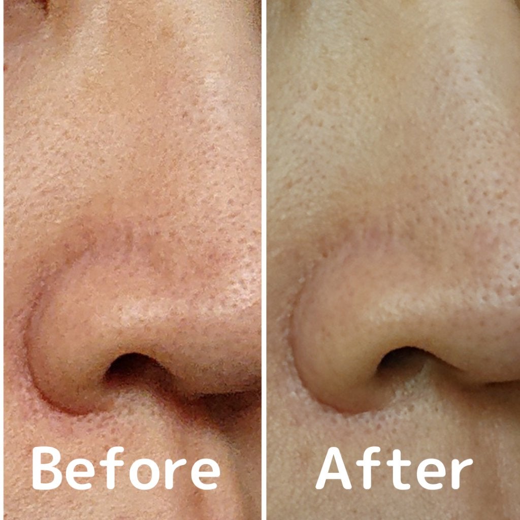 ããã ã®åç²§æ°Ž(ããã¥ãªãš ã¹ãã³ã³ã³ãã£ã·ã§ã㌠R )/ããã¥ãªãš/åç²§æ°Žã䜿ã£ãã¯ãã³ãïŒ2æç®ïŒ