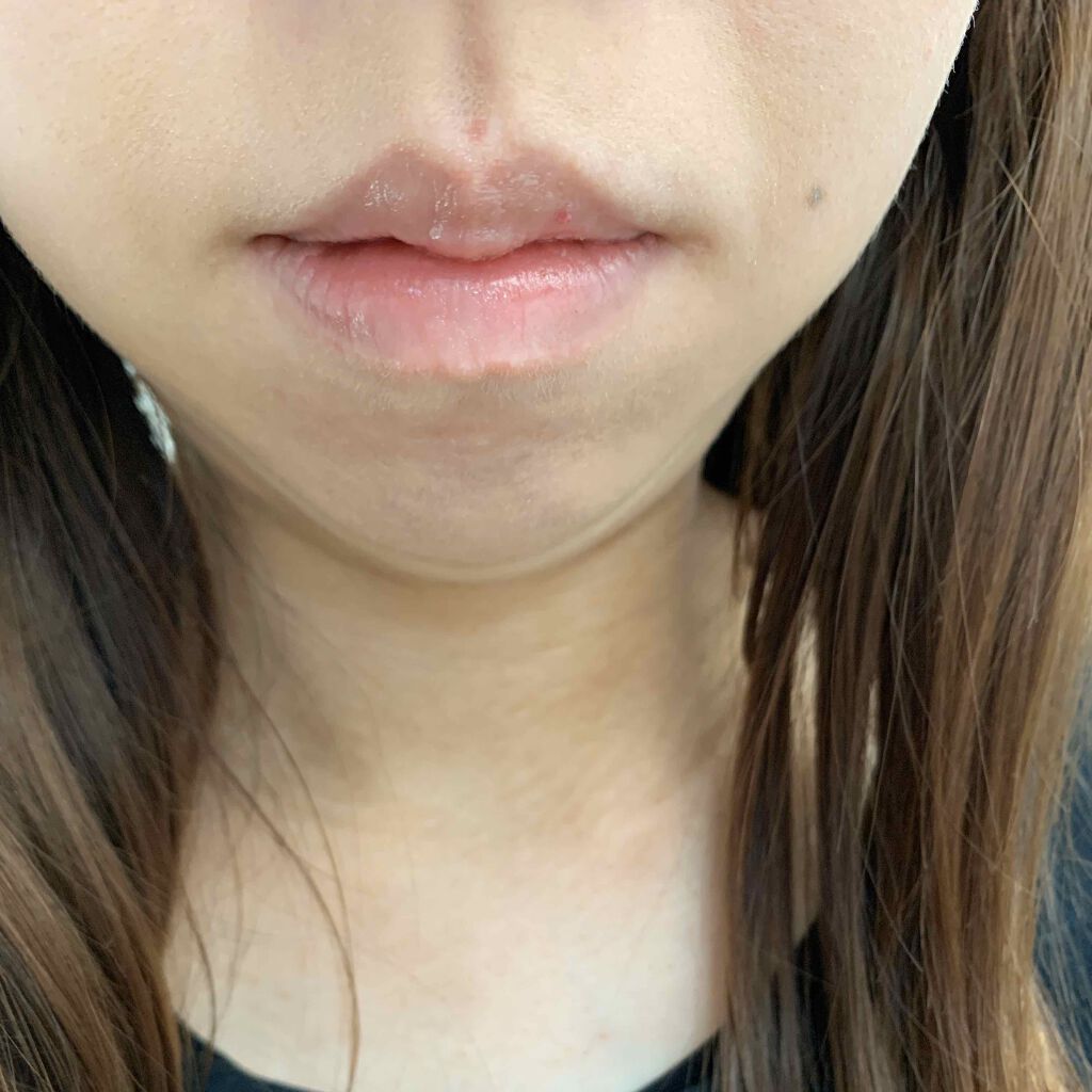 高保湿リップクリーム/ケアセラ/リップケアを使ったクチコミ（2枚目）