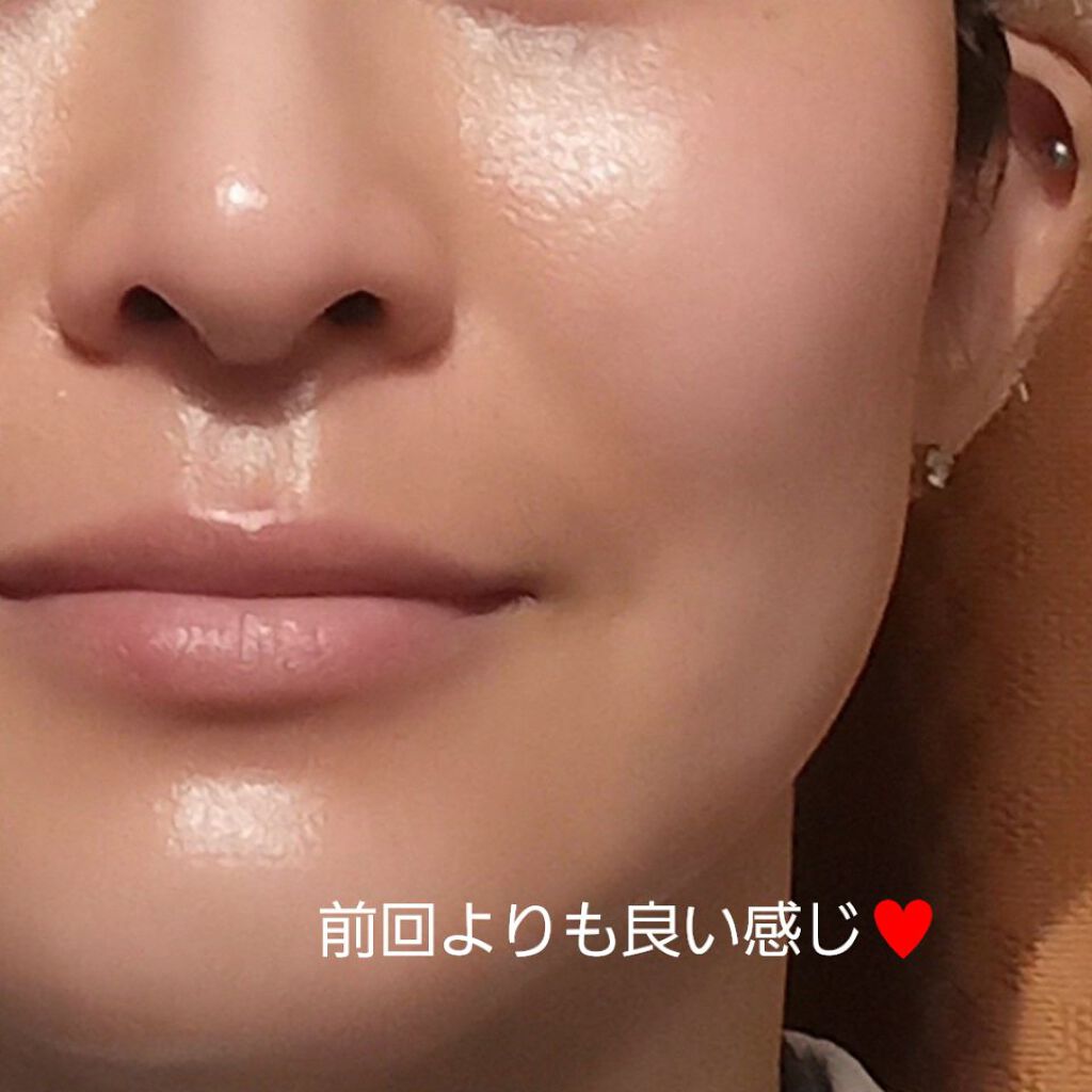 ダーマペン・ダーマスタンプ/MyM/その他スキンケアグッズを使ったクチコミ（2枚目）