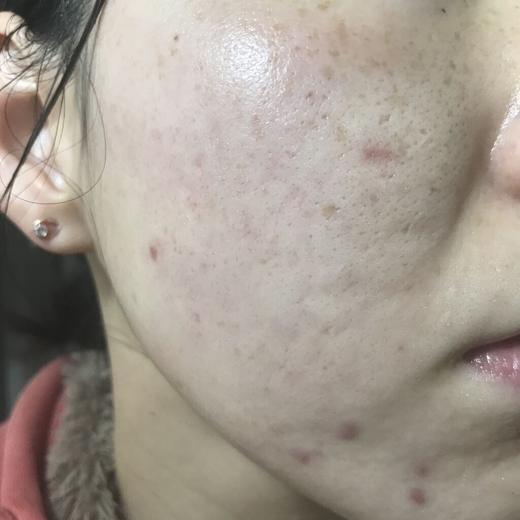 ビオオイル アルガンオイル/Melvita/フェイスオイルを使ったクチコミ（1枚目）