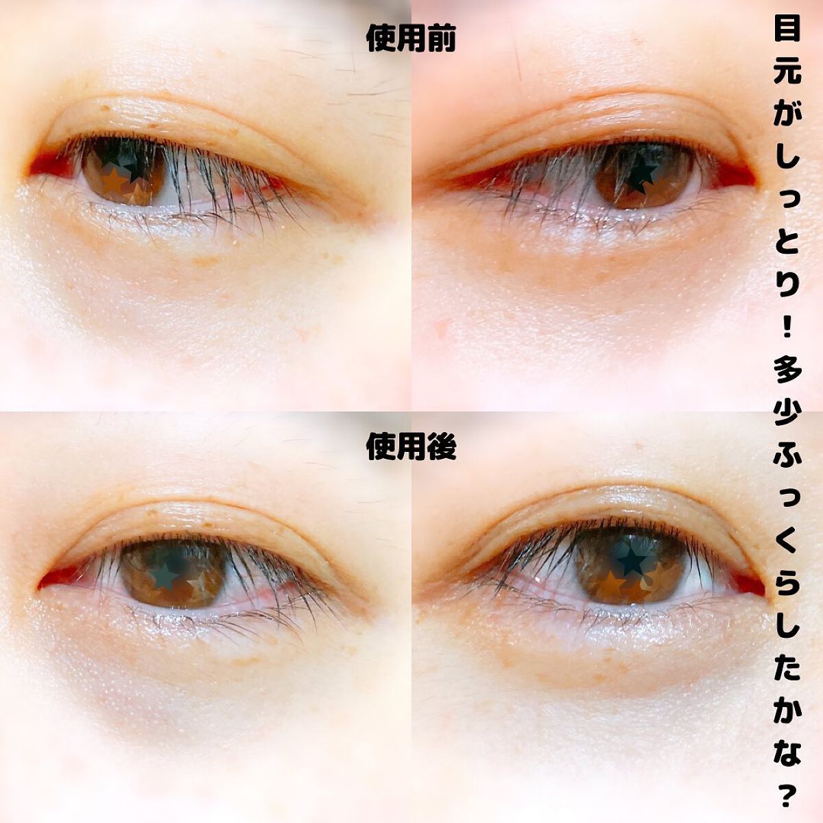 NEEDROP/NISSHA/シートマスク・パックを使ったクチコミ(6枚目)