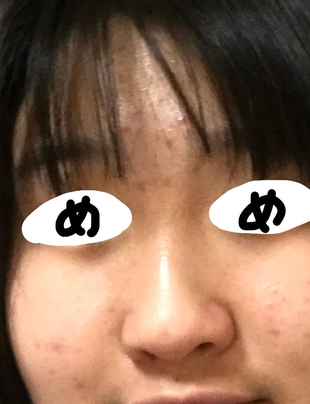 薬用 しみ 集中対策 美容液/メラノCC/美容液を使ったクチコミ(3枚目)