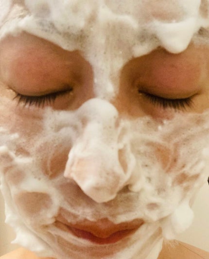 スキンピールバー AHA/サンソリット/洗顔石鹸を使ったクチコミ(6枚目)