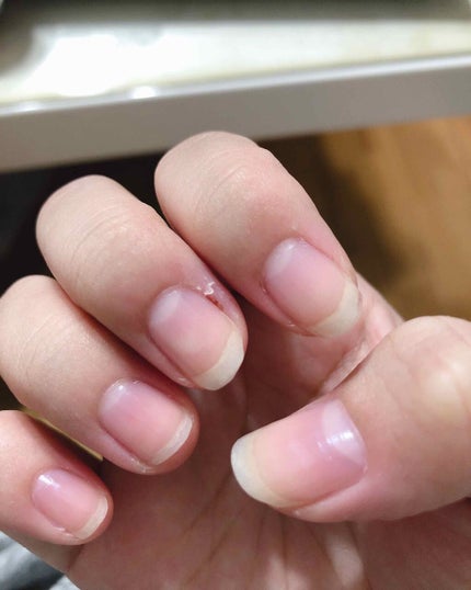 ネイルホリック ベースコート/ネイルホリック/ネイルベースコートを使ったクチコミ(1枚目)