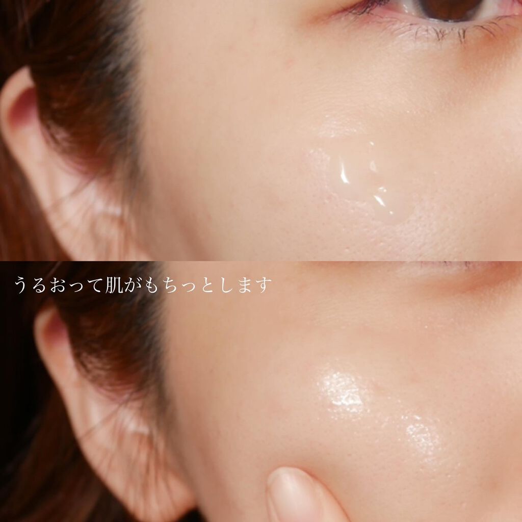 イプサ ME 6/IPSA/化粧水を使ったクチコミ(4枚目)