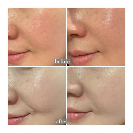 キル カバー メッシュ グロウ クッション/CLIO/クッションファンデーションを使ったクチコミ(6枚目)