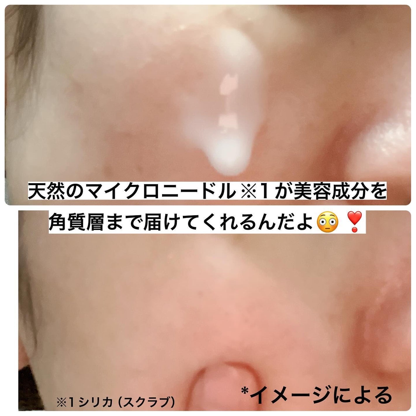 ピーディーアールエヌエッセンス PDRN 100/VT/美容液を使ったクチコミ(5枚目)