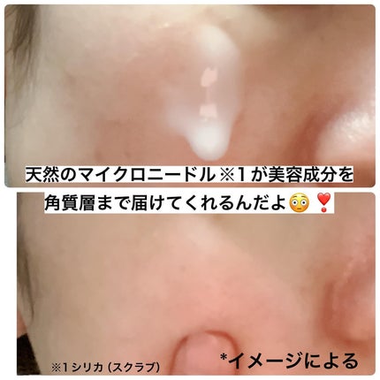 ピーディーアールエヌエッセンス PDRN 100/VT/美容液を使ったクチコミ(5枚目)