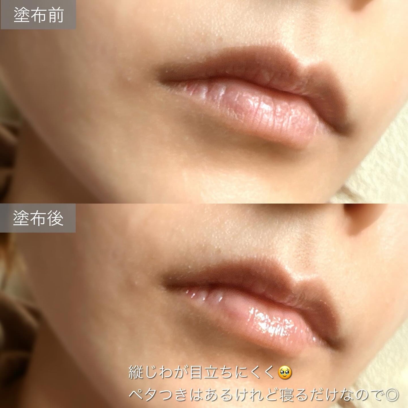 リップガーディアン スリーピング リップセラム/LIPGUARDIAN/リップ美容液を使ったクチコミ(5枚目)