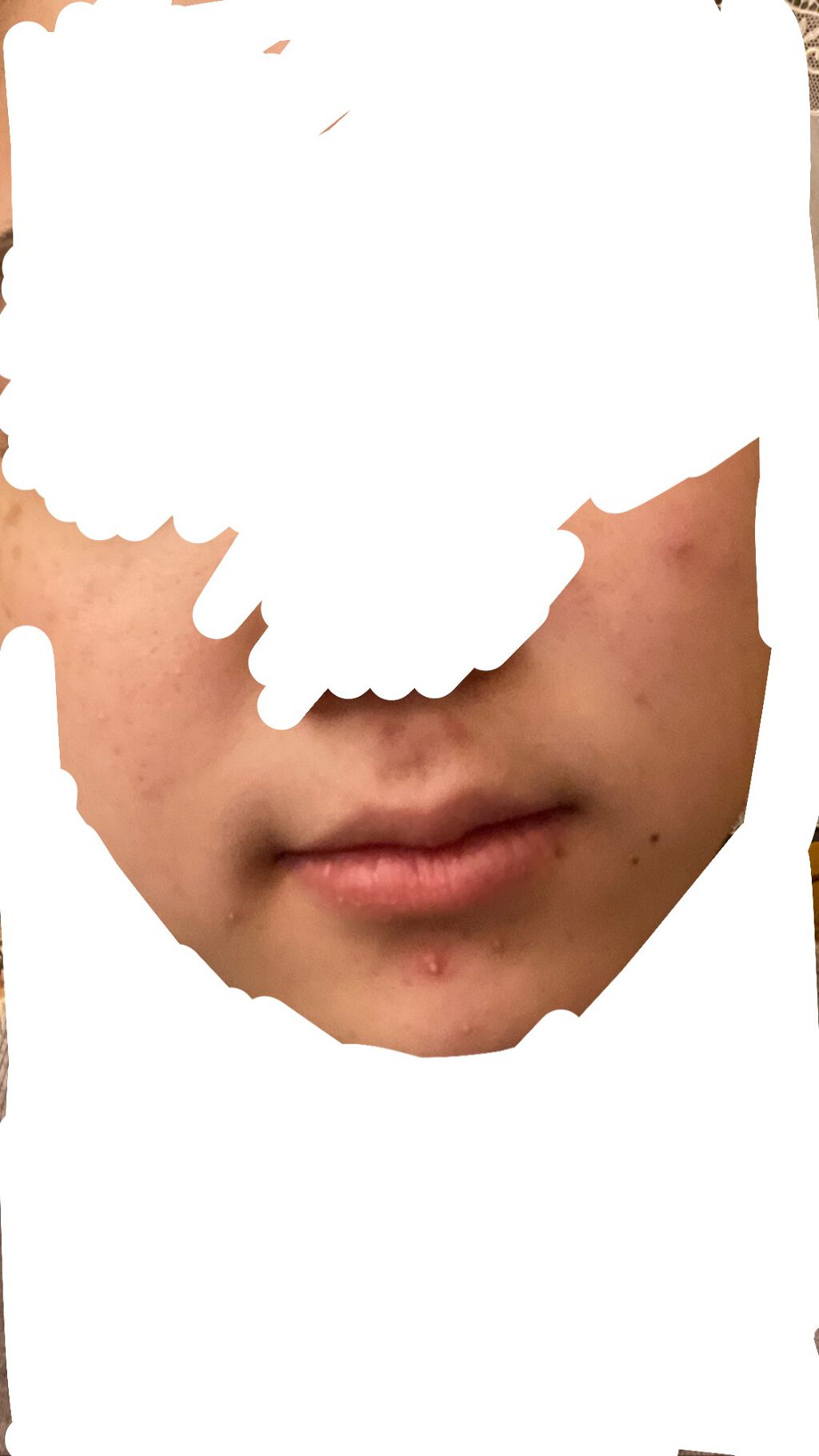 A アクネフォーム/NOV/洗顔フォームを使ったクチコミ(1枚目)