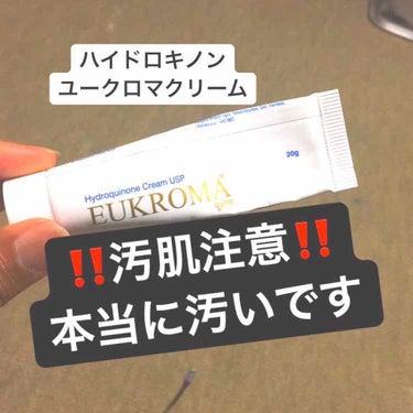 EUKROMA EUKROMA　ハイドロキノンクリーム4%　20gのクチコミ「‼️汚肌注意‼️
ご覧いただきありがとうございます。

ニキビを楽しく潰していたら跡になってし.....」（1枚目）