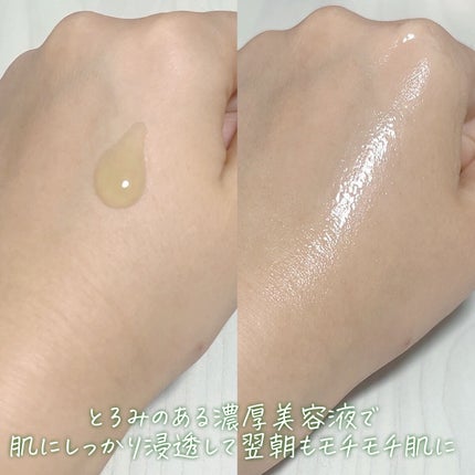 Noni Ampule/celimax/美容液を使ったクチコミ(3枚目)