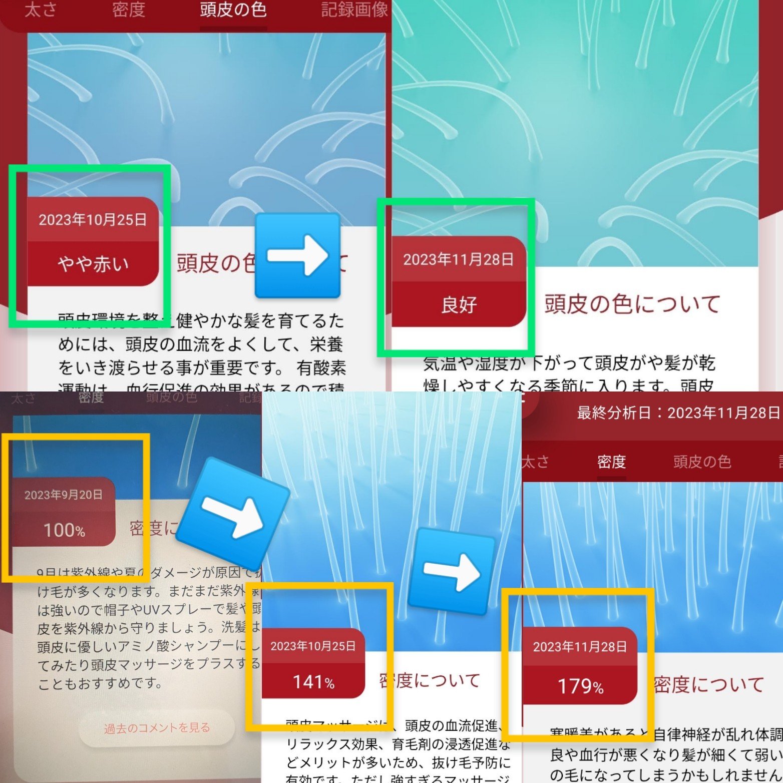 薬用育毛エッセンス/Dr.Keller/頭皮ローションを使ったクチコミ（1枚目）