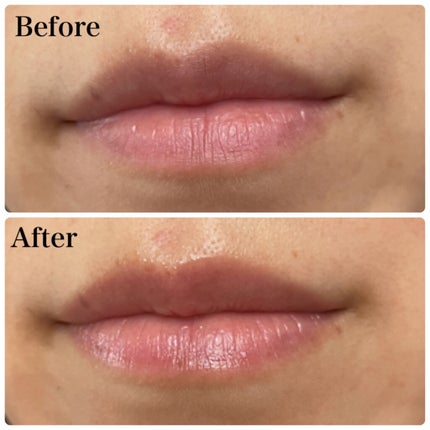 ディオール アディクト リップ グロウ/Dior/リップバームを使ったクチコミ(2枚目)