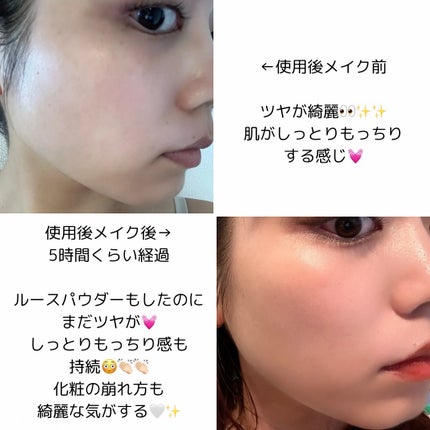 Skin Barrier Calming Lotion/Ongredients/乳液を使ったクチコミ(6枚目)