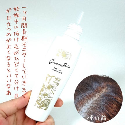 growbio/JYU-KEN/頭皮ローションを使ったクチコミ(2枚目)