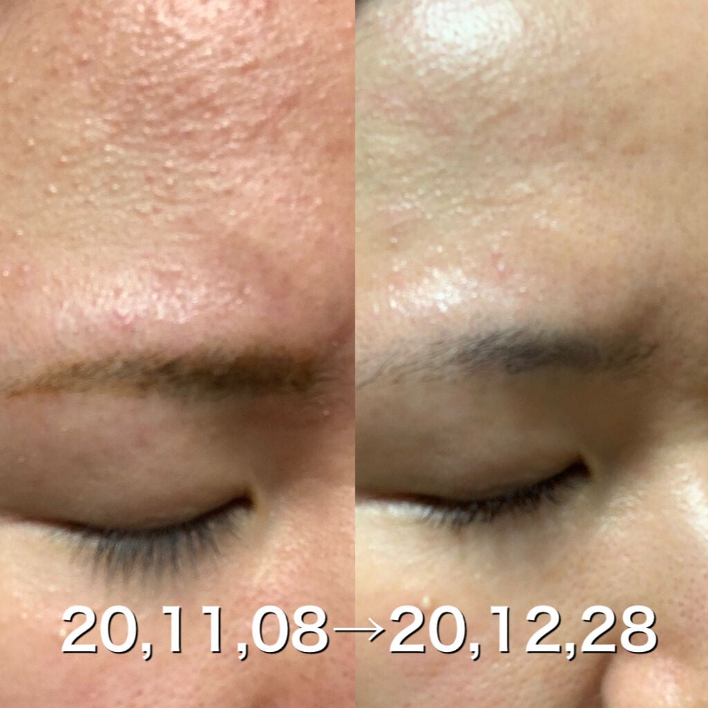 ザ・タイムR アクア/IPSA/化粧水を使ったクチコミ(2枚目)