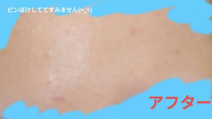 薬用フェイスクリーム/DAISO/フェイスクリームを使ったクチコミ(4枚目)