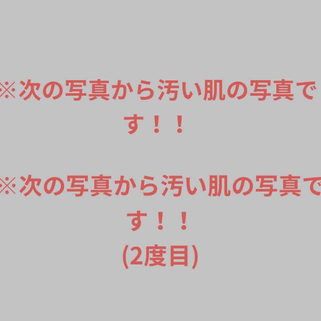 ハトムギ化粧水(ナチュリエ スキンコンディショナー R )/ナチュリエ/化粧水を使ったクチコミ（2枚目）