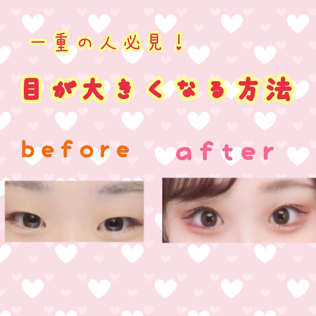 のびーるアイテープ（絆創膏タイプ、レギュラー）/DAISO/二重まぶた用アイテムを使ったクチコミ（1枚目）