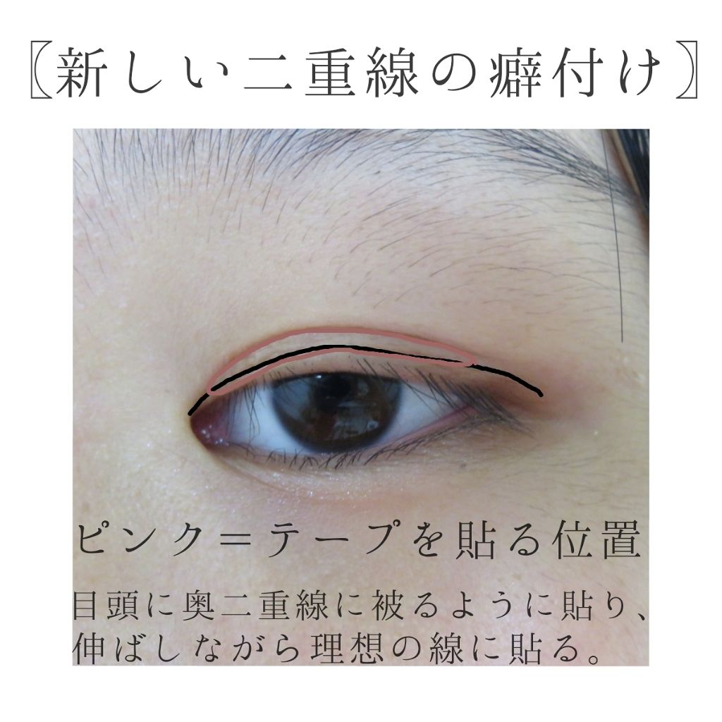 二重になる方法 アイテープ 絆創膏タイプ レギュラー 70枚 Daisoの使い方や二重メイク こんにちは ナリタノ です By ナリタノ 10代前半 Lips 二重になる方法 アイテープ 絆創膏タイプ レギュラー 70枚 Daisoの使い方や二重メイク こんにちは ナリタノ です By ナリタノ 10代前半 Lips