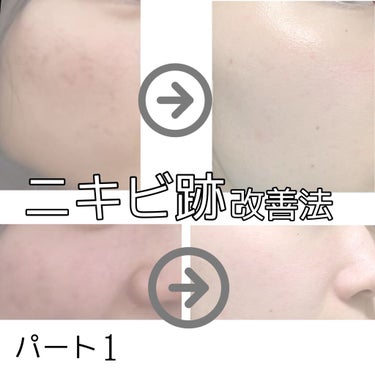 キールズ DS クリアリーブライト エッセンス[医薬部外品]/Kiehl's/美容液を使ったクチコミ（1枚目）