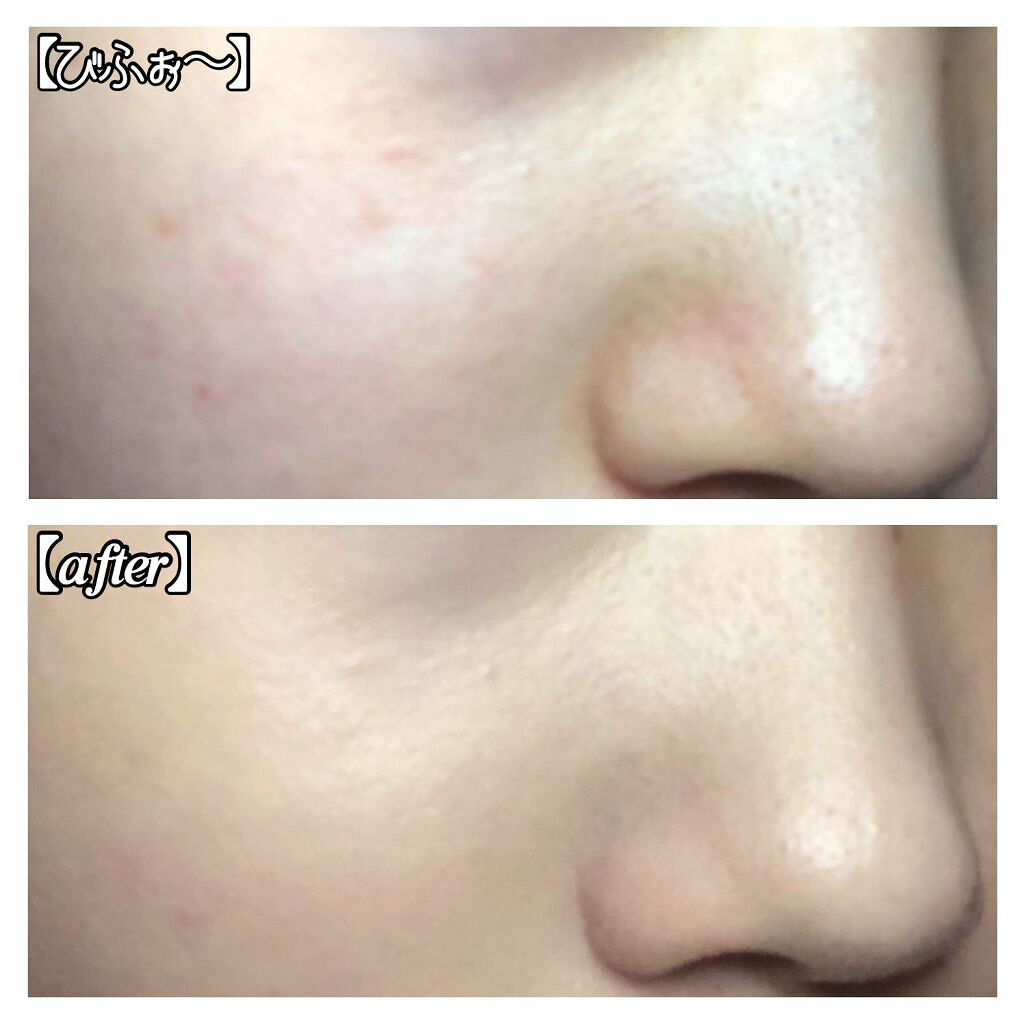 ピンクティーツリーカバークッション/APLIN/クッションファンデーションを使ったクチコミ（3枚目）