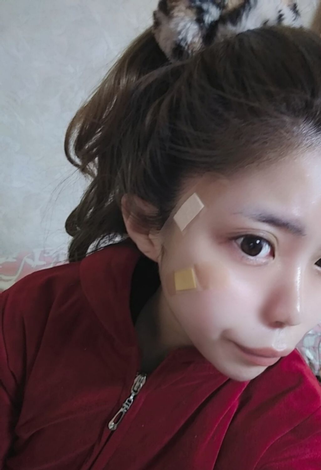 オロナインＨ軟膏 (医薬品)/オロナイン/その他を使ったクチコミ（1枚目）