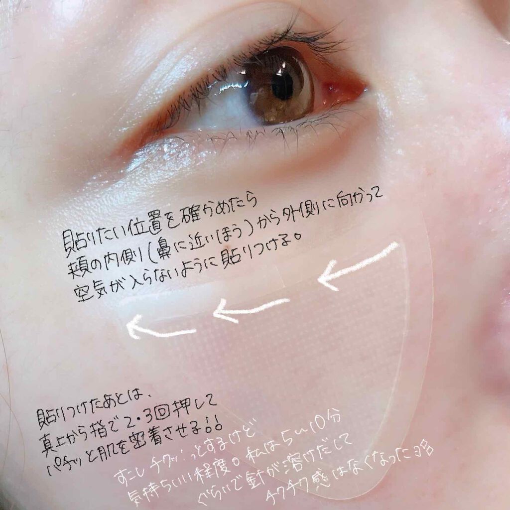 チークポアパッチ/北の快適工房/シートマスク・パックを使ったクチコミ(4枚目)