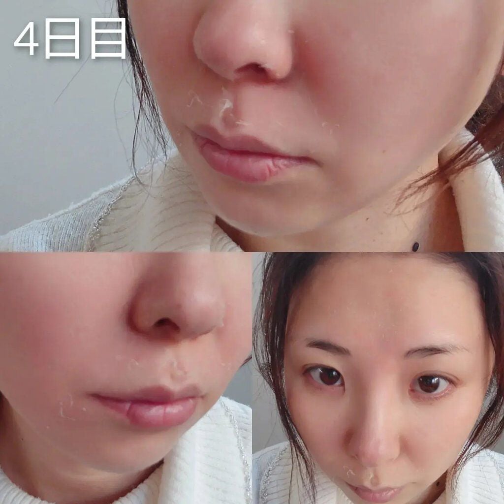 ゆなcc:フォロバ100 on LIPS 「BQCELLダーマスキンケアピーリング🎊1week体験投稿🎊1..」(5枚目)