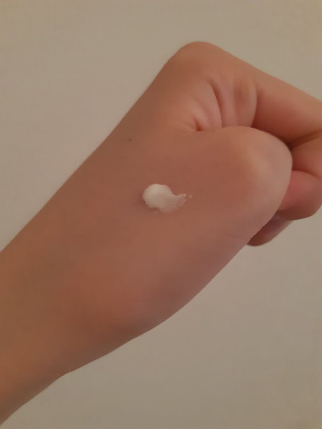 ニキビ治療薬(医薬品)/メンソレータム アクネス/その他を使ったクチコミ(5枚目)