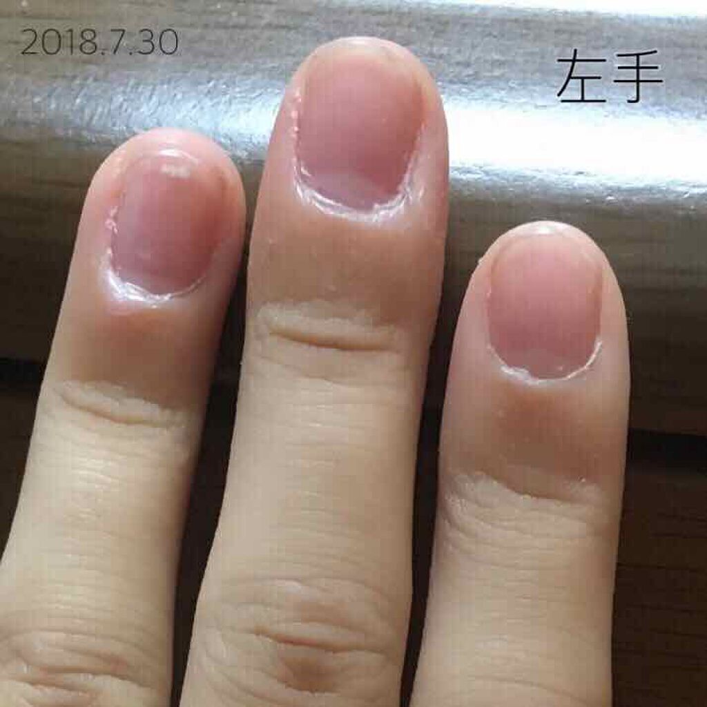 エテュセ クイックケアコート/ettusais/ネイルオイル・トリートメントを使ったクチコミ（2枚目）