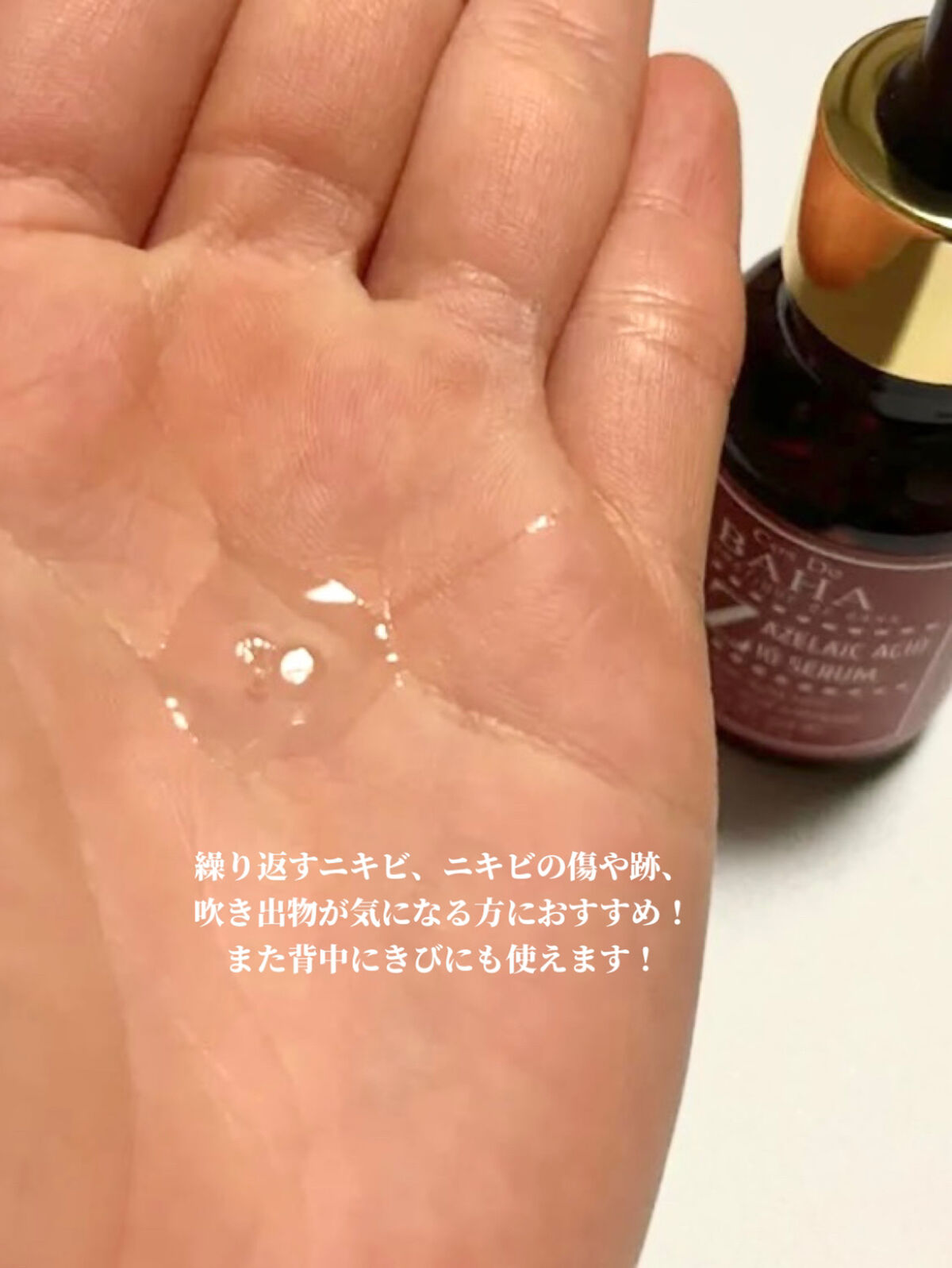 AZアゼライン酸10セラム/コスデバハ/美容液を使ったクチコミ（3枚目）