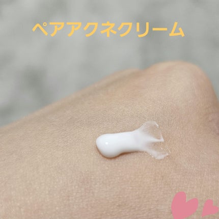 ペアアクネクリームW(医薬品)/ペア/その他を使ったクチコミ(2枚目)