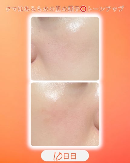 TXトーニングクリーム/VT/フェイスクリームを使ったクチコミ(2枚目)