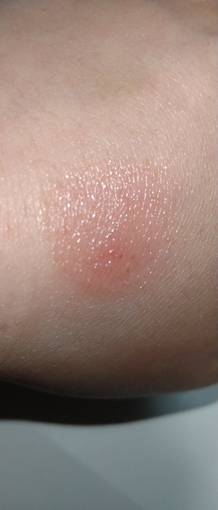 サクラヴェールリップ/パラドゥ/リップクリームを使ったクチコミ(6枚目)