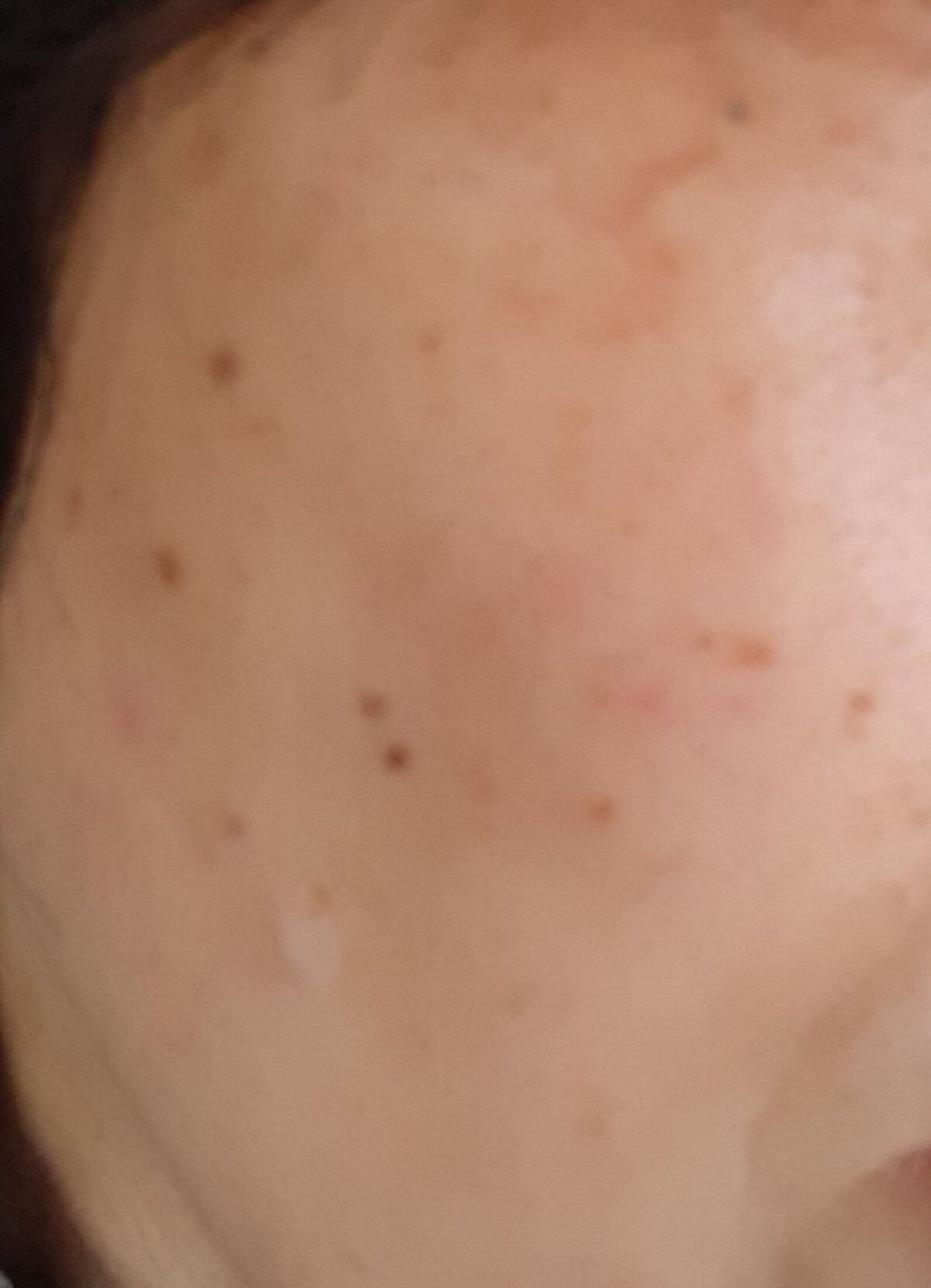 クラリフィック ブライトニング セラム/LANCOME/美容液を使ったクチコミ（1枚目）