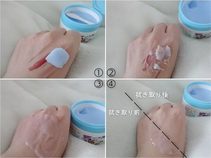 夢みるバーム アクネクリアモイスチャー/ロゼット/クレンジングバームを使ったクチコミ(2枚目)