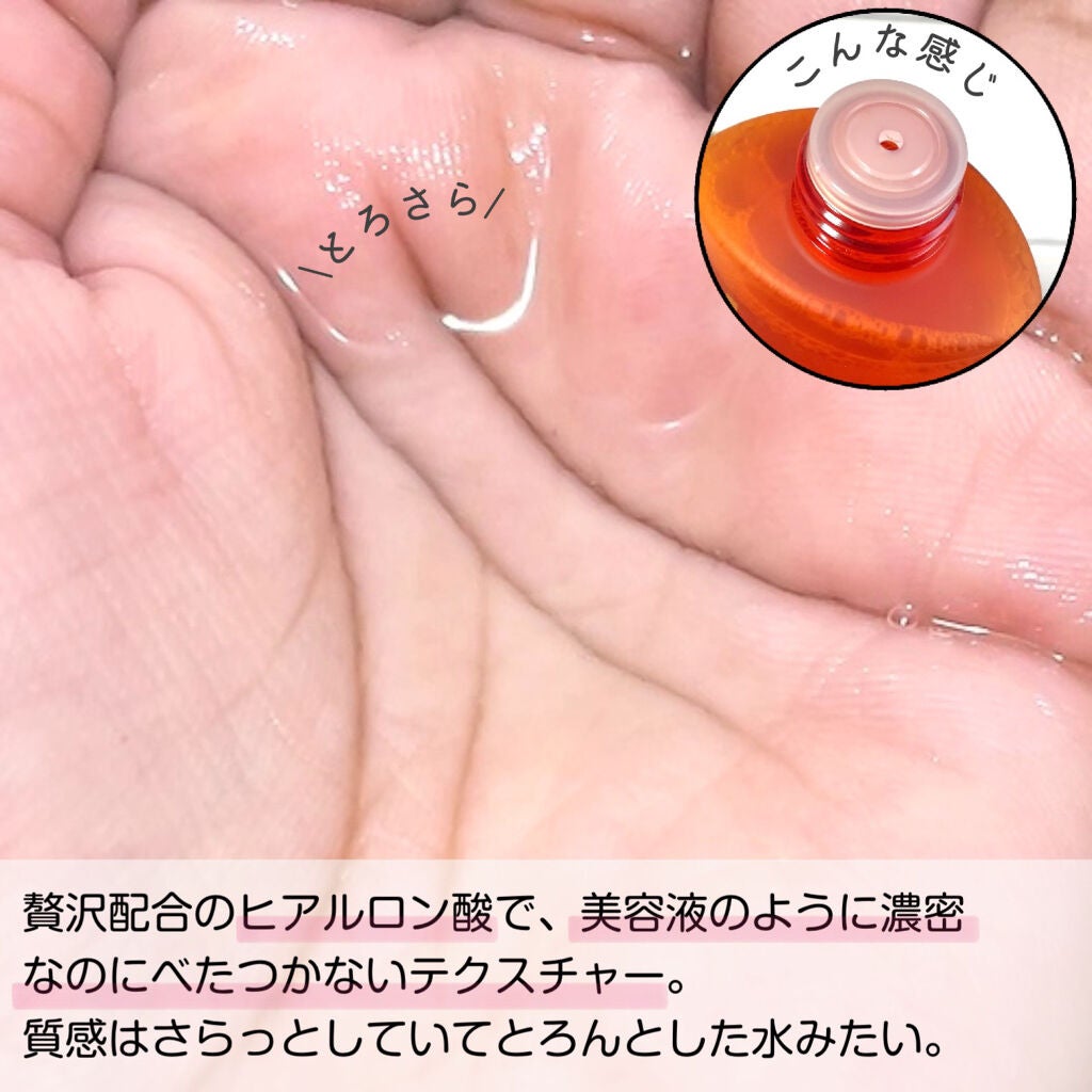 VC100エッセンスローション EX/ドクターシーラボⓇ/化粧水を使ったクチコミ(4枚目)