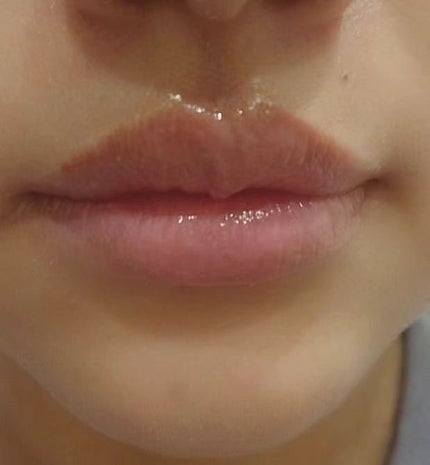 イリュン コラーゲンモイスチャーリップマスク/illuN/リップマスクを使ったクチコミ(5枚目)