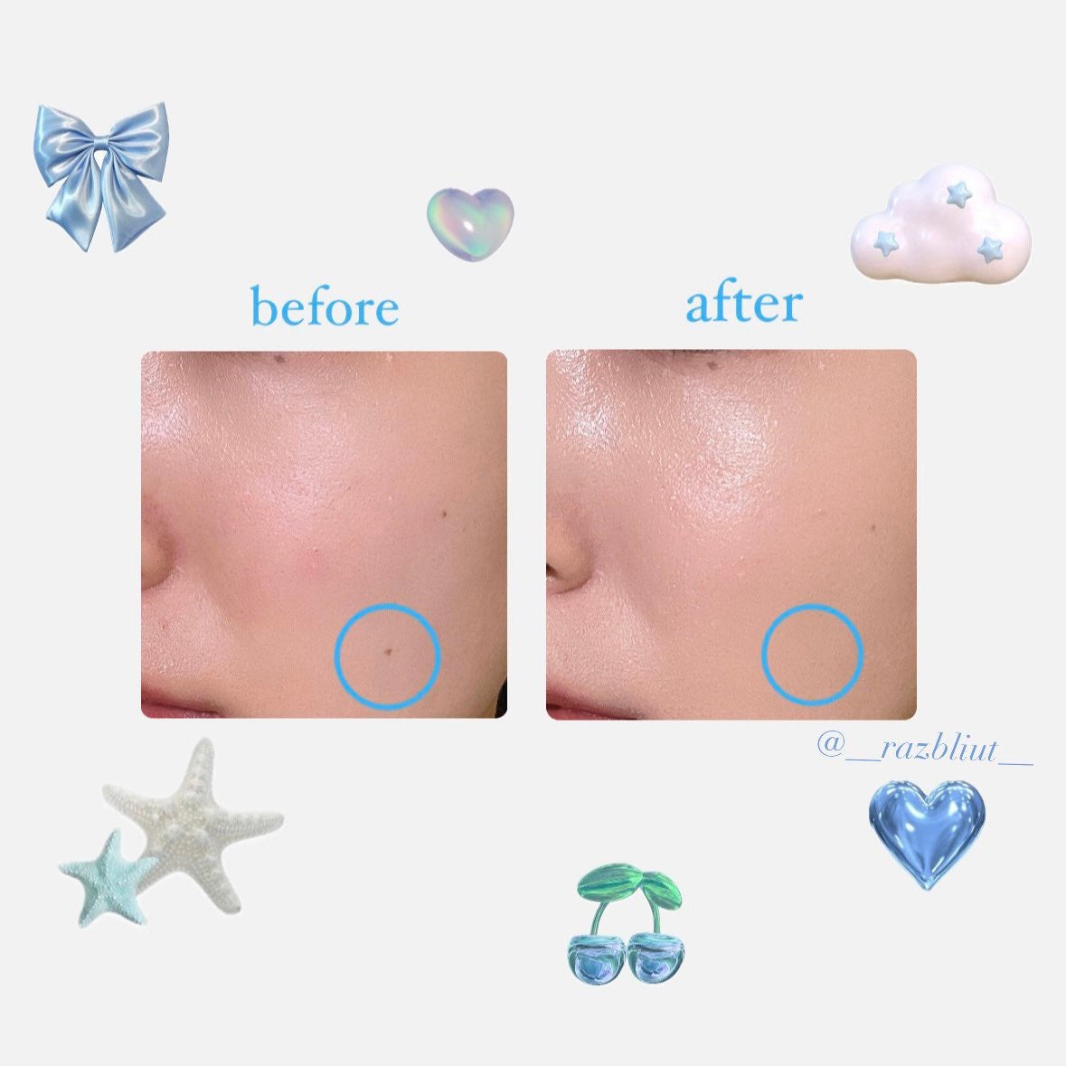 グロー マットクッション/APRILSKIN/クッションファンデーションを使ったクチコミ(4枚目)