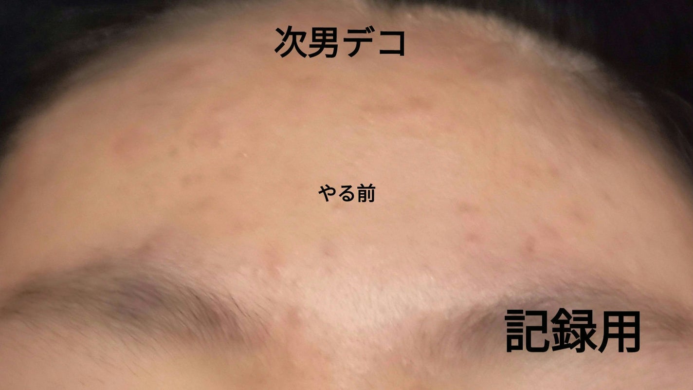 ナチュラルパック /MIRANAL/洗い流すパック・マスクを使ったクチコミ(1枚目)