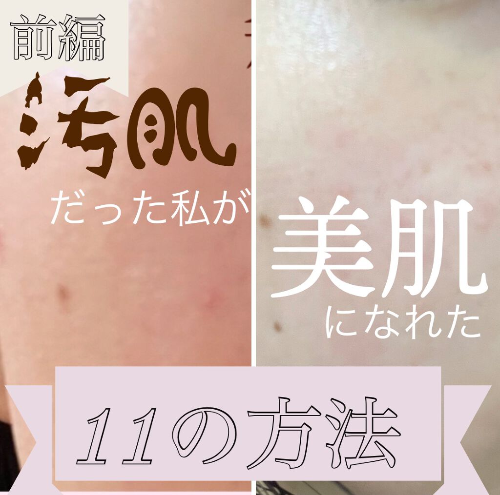 マイルドソープ/DHC/洗顔石鹸を使ったクチコミ(1枚目)