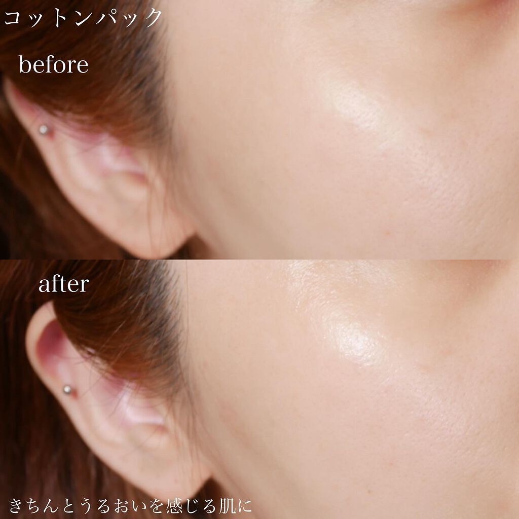 クインス ローション/Quince/化粧水を使ったクチコミ(4枚目)