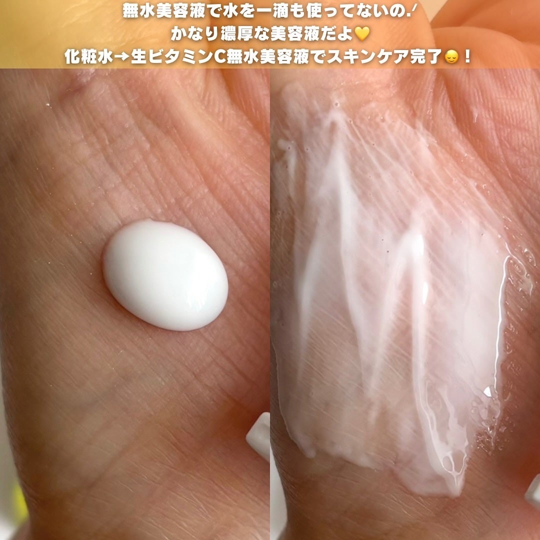 ビタペアC ビタレチ美容液/ネイチャーリパブリック/美容液を使ったクチコミ(2枚目)