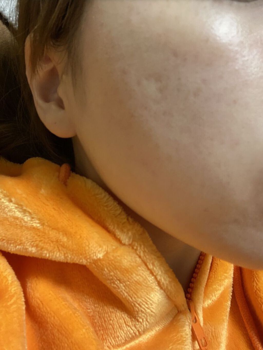 アピットジェル/全薬工業/美容液を使ったクチコミ（1枚目）